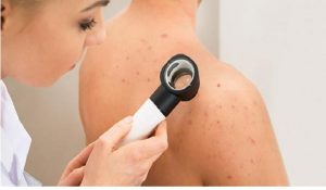 Dermatoloji nedir ? Dermatolog ne iş yapar ?
